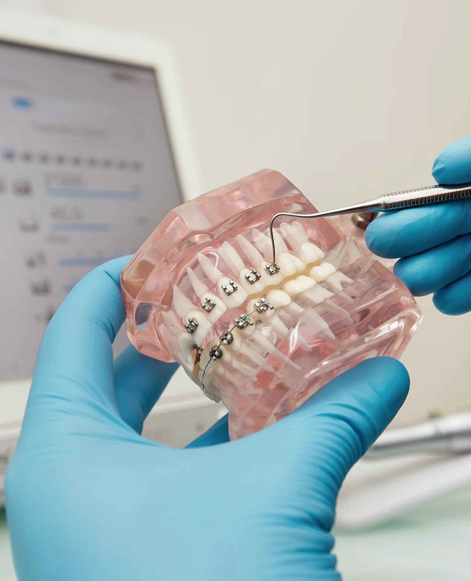 Orthodontie bij Praktijk Molenweg.
