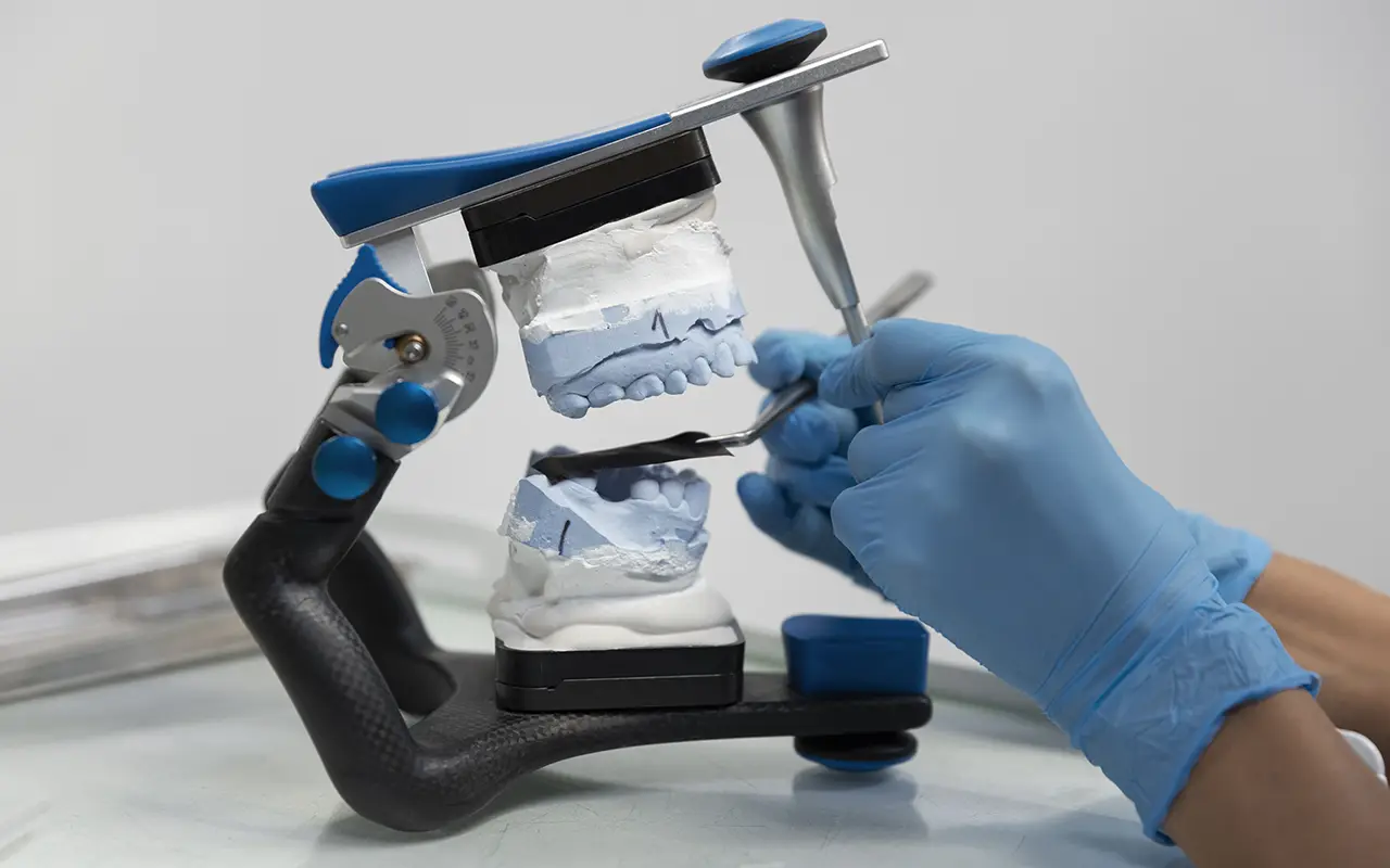 Een anti-snurkbeugel MRA wordt volledig op maat gemaakt bij Praktijk Molenweg