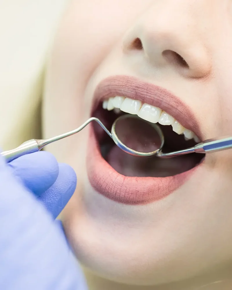 Anti-snurkbeugel MRA bij Praktijk Molenweg in Baarn